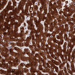PPP2R2D Antibody, Novus Biologicals:Antibodies:Primary Antibodies